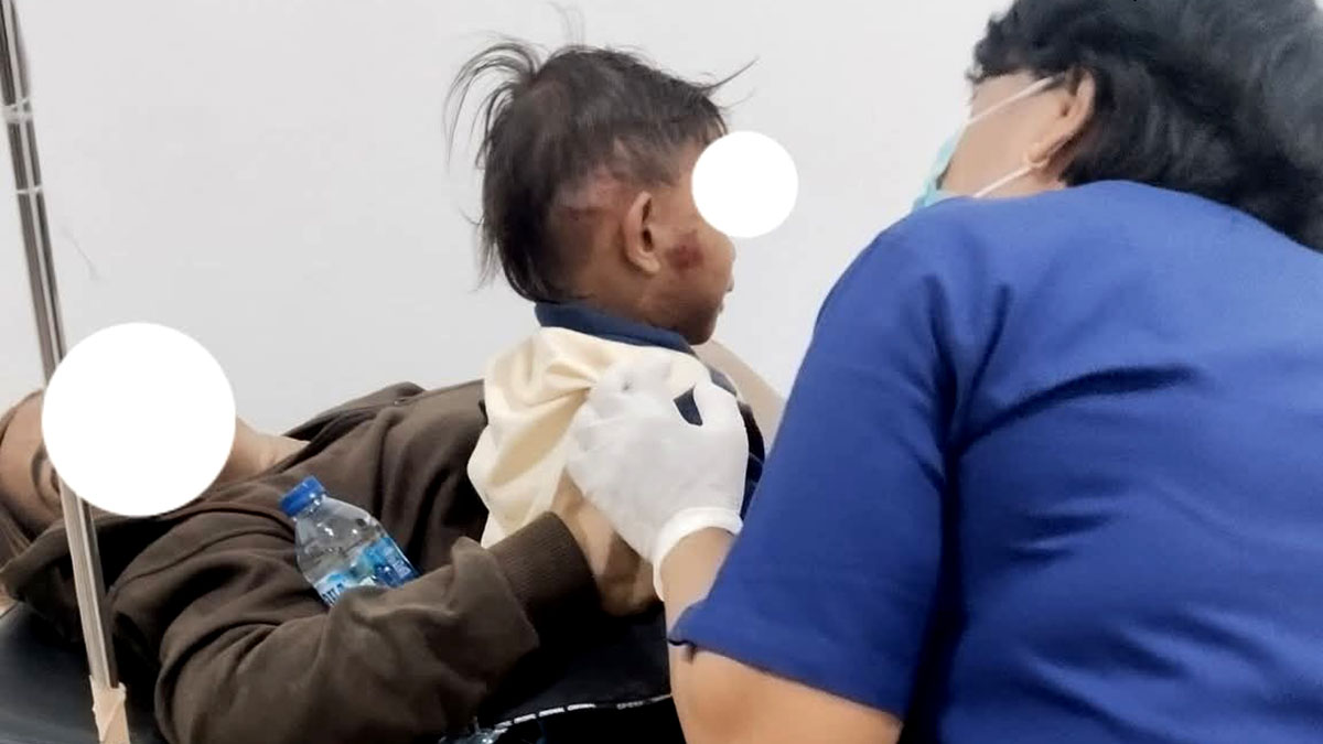 Seorang anak bersama ibunya mendapat perawatan medis di Puskesmas Sausu usai terjatuh akibat melintasi jalan berlubang di jalur trans Sulawesi, Kecamatan Sausu, Kabupaten Parigi Moutong, Sulawesi Tengah, Minggu (5/10/2025). Foto: FB Muhammad Baharuddin Hafidz